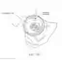 Fig. 16 - Method and apparatus for distracting a joint, including the provision and use of a novel fluid joint spacer