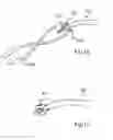 Fig. 08 - Device and method for hip distention and access