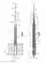 Fig. 02 - Distractor with removable footplates