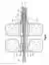 Fig. 05 - Distractor with removable footplates