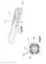 Fig. 26 - Distractor with removable footplates
