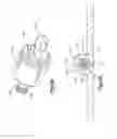 Fig. 28 - Distractor with removable footplates