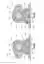 Fig. 34 - Distractor with removable footplates