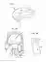 Fig. 02 - Apparatus and method for heart valve repair