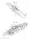 Fig. 03 - Apparatus and method for heart valve repair