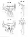Fig. 04 - Apparatus and method for heart valve repair