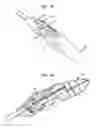Fig. 05 - Apparatus and method for heart valve repair