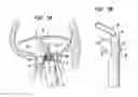 Fig. 06 - Apparatus and method for heart valve repair