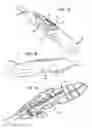 Fig. 08 - Apparatus and method for heart valve repair