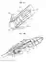 Fig. 09 - Apparatus and method for heart valve repair