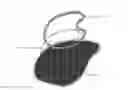 Fig. 01 - Implantable hernia prosthesis with an uninterrupted ring