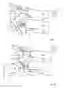 Fig. 06 - Endoscopic instrument