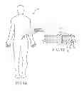Fig. 02 - DEVICES AND METHOD FOR TREATING WOUNDS