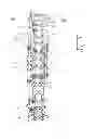 Fig. 01 - Spinal correction and secondary stabilization