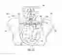 Fig. 09 - BONE SCREW SYSTEM AND DEVICES PROVIDING SACROILIAC STABILIZATION