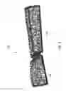 Fig. 09 - SYSTEM FOR ANATOMICAL REDUCTION OF BONE FRACTURES