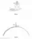 Fig. 04 - Managing back pain by applying a high frequency electrical stimulus directly to the spinal cord