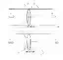 Fig. 03 - IMPLANTABLE PROSTHETIC DEVICE FOR CONNECTION TO A FLUID FLOW PATHWAY OF A PATIENT AND METHODS OF USING THE SAME