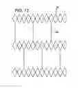 Fig. 06 - Expandable sheath for introducing an endovascular delivery device into a body