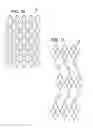 Fig. 09 - Expandable sheath for introducing an endovascular delivery device into a body