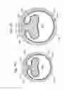 Fig. 28 - Expandable sheath for introducing an endovascular delivery device into a body