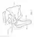 Fig. 02 - Variable angle reverse humeral tray