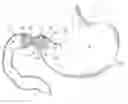 Fig. 01 - Pyloric obesity valve