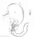 Fig. 02 - Pyloric obesity valve