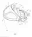 Fig. 02 - Headgear with a spring buffered occipital cradle