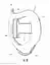 Fig. 11 - Headgear with a spring buffered occipital cradle