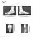Fig. 09 - Leg wear