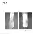 Fig. 10 - Leg wear
