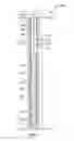 Fig. 02 - Downhole-adjusting impact apparatus and methods
