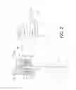 Fig. 04 - Bicycle brake caliper assembly