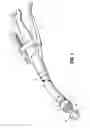 Fig. 02 - Surgical instrument buttress attachment