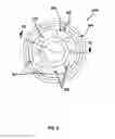Fig. 10 - Compression spring assembly and method