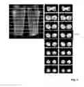 Fig. 04 - MR imaging with Bmapping