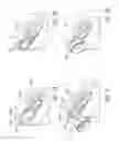 Fig. 04 - REMOVABLE LENSES FOR MOBILE ELECTRONIC DEVICES
