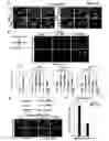 Fig. 19 - Compositions And Methods For Treating Steatohepatitis, Liver Fibrosis, and Hepatocellular Carcinoma (HCC)