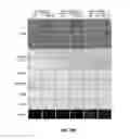Fig. 30 - Compositions And Methods For Treating Steatohepatitis, Liver Fibrosis, and Hepatocellular Carcinoma (HCC)