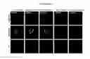 Fig. 07 - NOVEL FORMS OF PLANT DEFENSINS