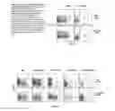 Fig. 06 - Methods of promoting immunity to an infectious agent by administering CD40 agonists and alpha-galactosyl ceramide