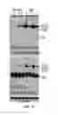 Fig. 16 - Methods of treating brain injury