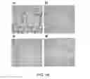 Fig. 18 - Angiogenic and Immunologic Applications of Anti-CD160 Specific Compounds Obtainable From mAb CL1-R2