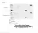 Fig. 19 - Anti-malignant tumor agent