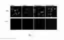 Fig. 06 - RECOMBINANT POLYPEPTIDE FOR ENHANCING CELL TRANSDUCTION EFFICIENCY OF A TARGET AGENT