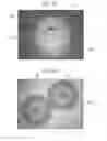Fig. 03 - Aerosol hairspray product comprising a spraying device