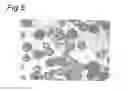 Fig. 04 - MICROPARTICLES COMPRISING PCL AND USES THEREOF