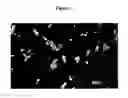 Fig. 03 - Nanoparticulate compositions and formulations of piperazine compounds