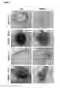 Fig. 02 - METHOD FOR THE PROGNOSIS OF SURVIVAL TIME OF A PATIENT SUFFERING FROM A SOLID CANCER